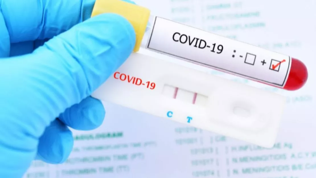 Covid-19 - Fin de la gratuité des tests à compter du 15 octobre