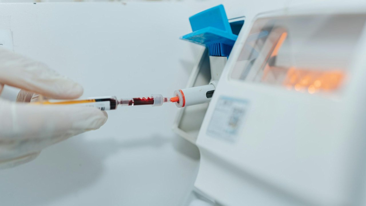 Dépistage du VIH sans rendez-vous ce 1er décembre à Nice Dépistage du VIH sans rendez-vous ce 1er décembre à Nice