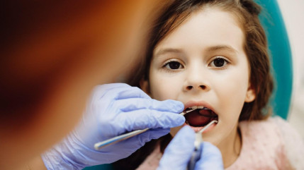 Halloween : après les bonbons, ne pas brosser trop vite les dents