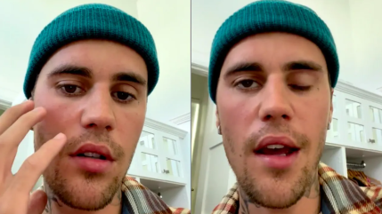 Justin Bieber : son état de santé s’améliore !